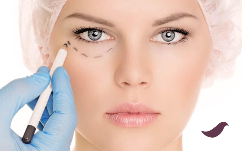 gözaltı morlukları-lazer tedavisi