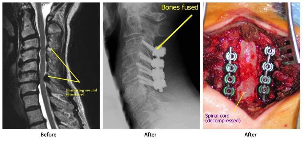 belde kanal darlığı